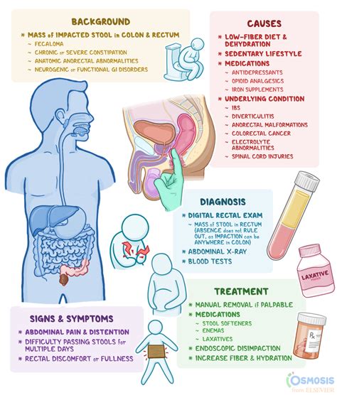 Fecal Impaction: What Is It, Causes, Tre